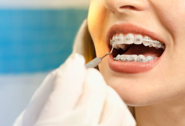 Orthodontic Treatment in Malad