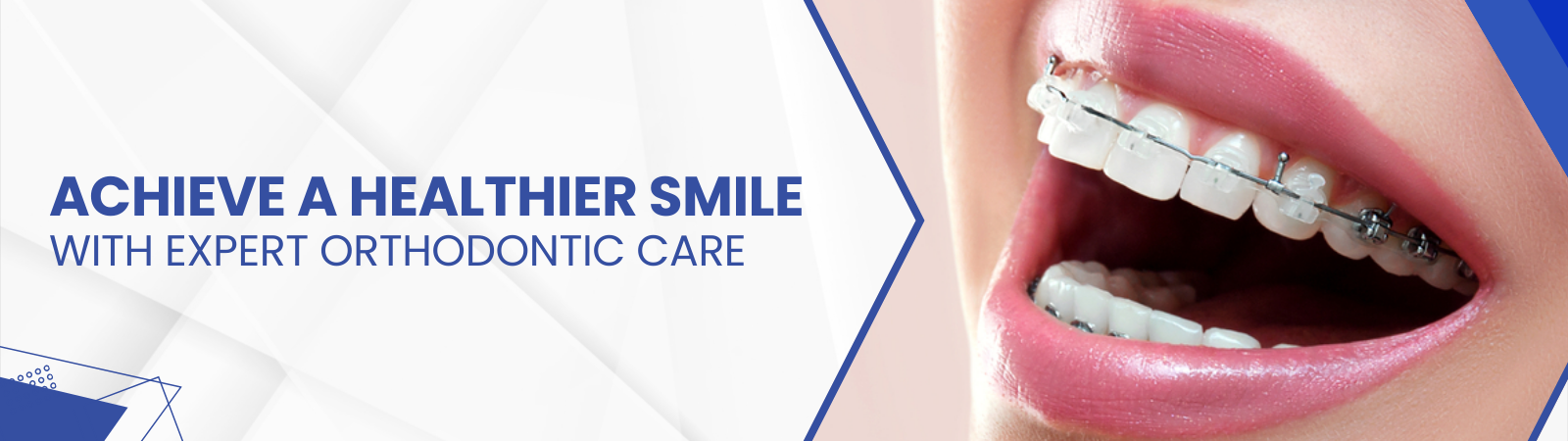 orthodontic-treatment-banner