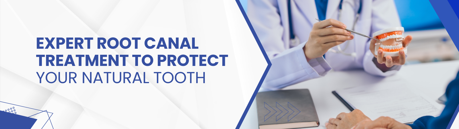 root-canal-banner