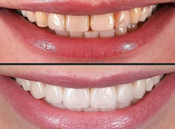 s8 - Impladent Pain-Free Dentistry