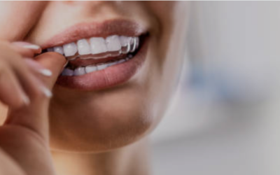 Can Invisalign Fix Your Bite? Understanding How It Works Compared to Braces