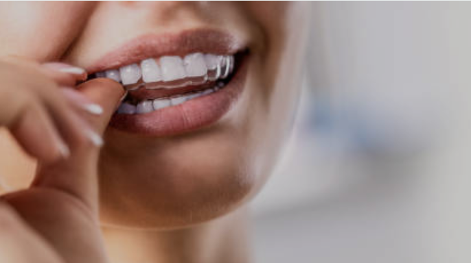 Close-up of a person applying a dental whitening strip to the upper teeth.